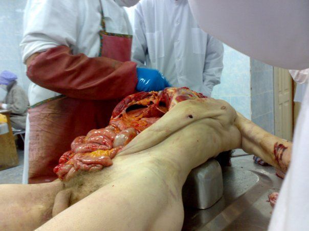 autopsy (6).jpg