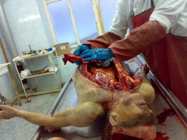 autopsy (9).jpg