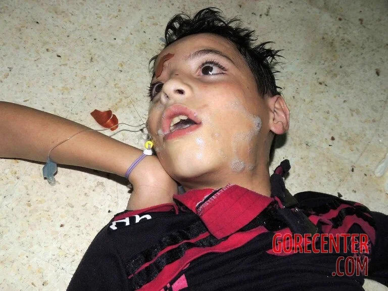 child-victims-of-chemical-attack-in-syria-2-447261454.webp