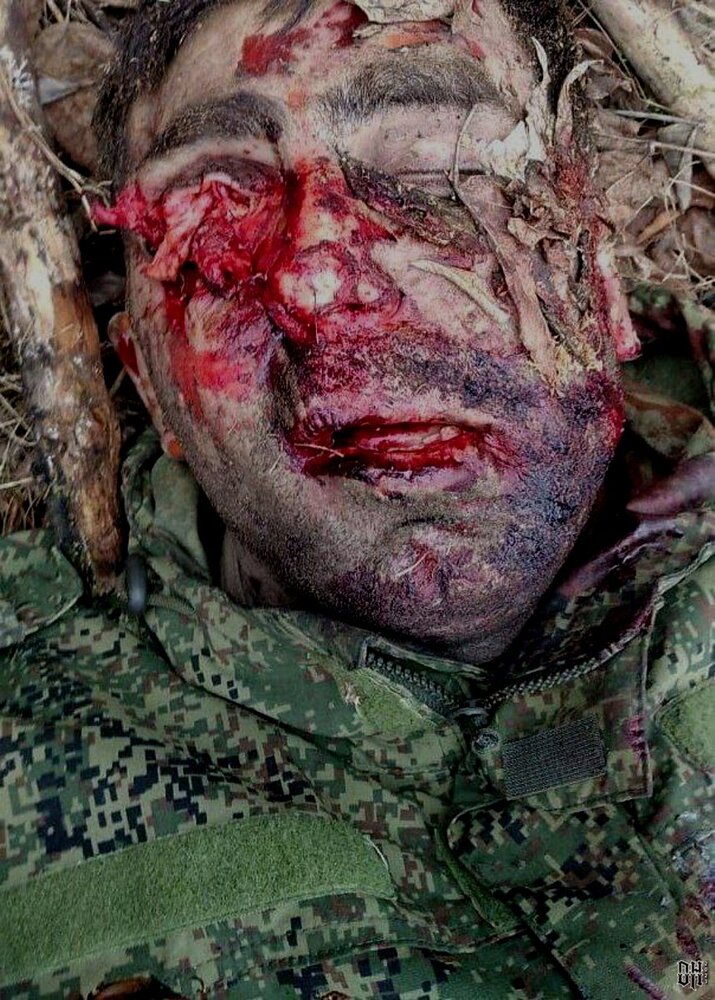 DH - Sldiers' Horror Faces and Bodies of Russia-Ukraine Conflict 27.jpg