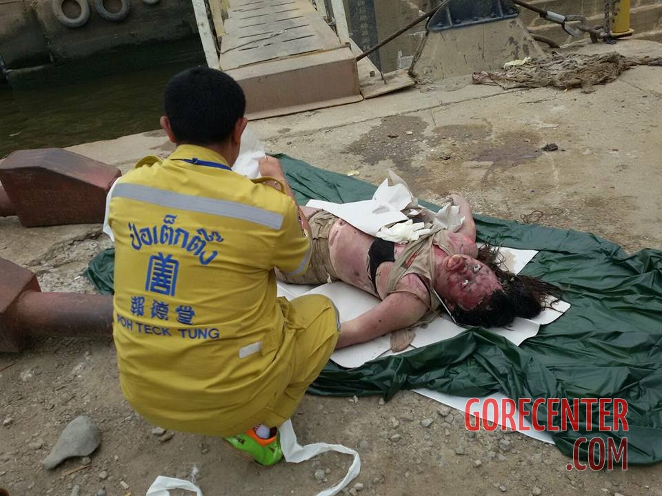 Drowned-and-bloated-Thai-woman-4.jpg