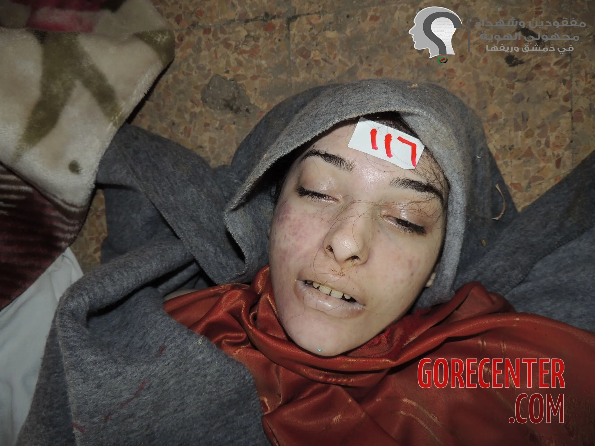 female-victims-of-chemical-attack-9-6837647734.webp