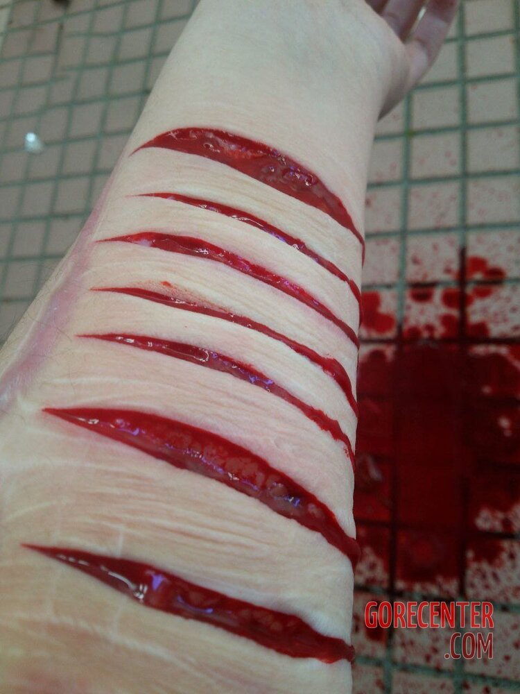 Really-deep-cuts-on-arm-7.jpg