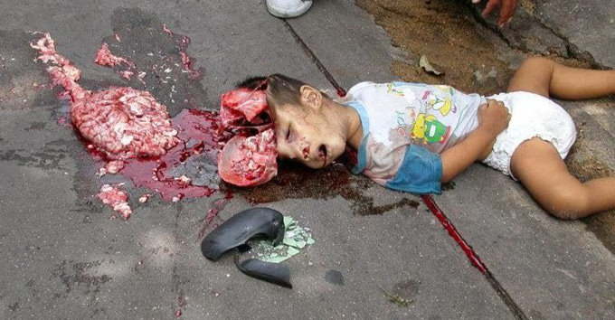 very-graphic-pictures-of-2-Year-old-toddler-01.jpg