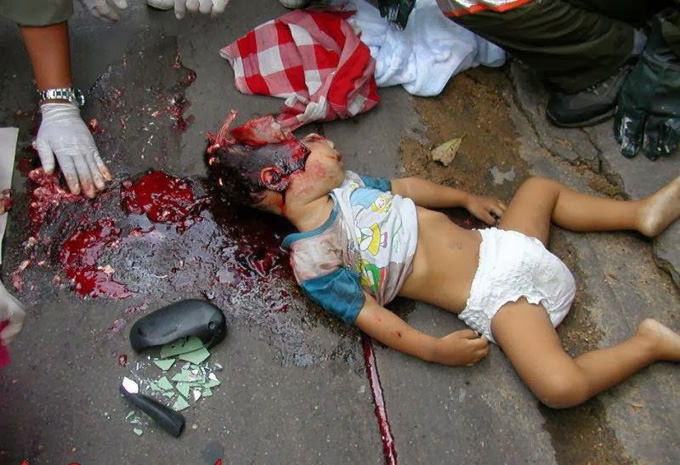 very-graphic-pictures-of-2-Year-old-toddler-03.jpg