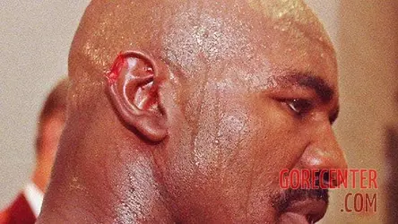 Mike-Tyson-bites-off-ear-of-his-opponent-Evander-Holyfield-4.webp