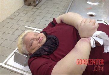 Morbidly-obese-woman-in-morgue-7.jpg