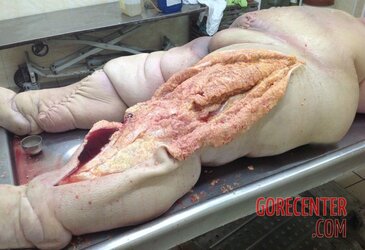 Morbidly-obese-woman-in-morgue-4.jpg