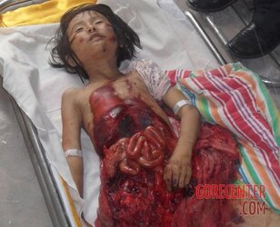 Chinese-7-year-old-village-girl-died-in-car-accident-3.jpg