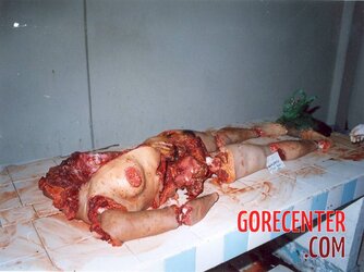 Female-victim-of-cannibal-3.jpg