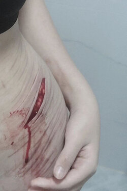 Deep-cuts-in-female-body-4.jpg