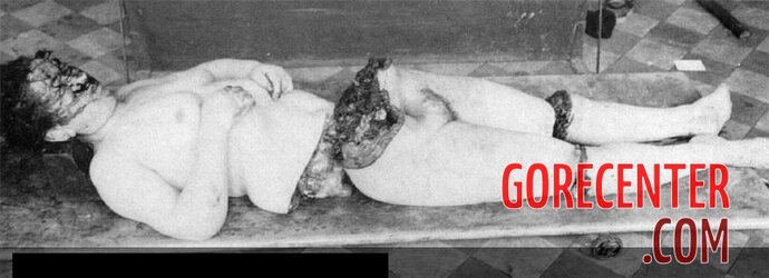 MIX-Old-photos-of-dismembered-women-2-1.jpg