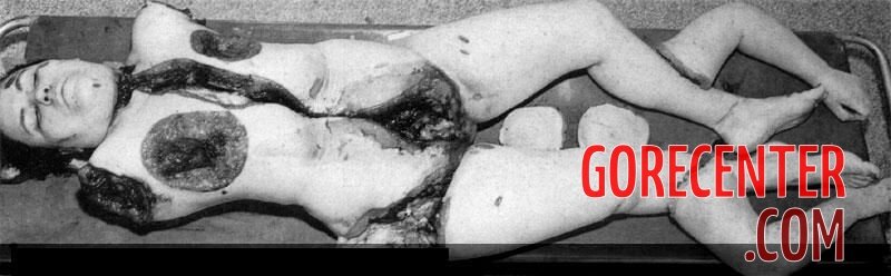 MIX-Old-photos-of-dismembered-women-2-5.jpg