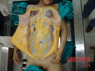 Brutally-raped-pregnant-Chinese-woman-in-morgue-19.jpg