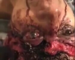 Maggots-eating-her-brain-while-shes-still-alive_thumb1-250x200.jpg