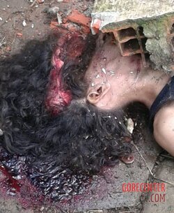 Young-girl-with-smashed-head-from-concrete-block-2.jpg