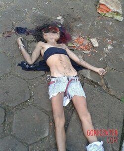 Young-girl-with-smashed-head-from-concrete-block-4.jpg