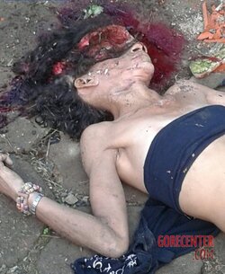 Young-girl-with-smashed-head-from-concrete-block-5.jpg