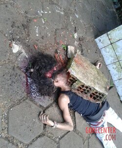 Young-girl-with-smashed-head-from-concrete-block-6.jpg