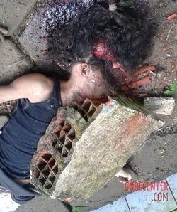 Young-girl-with-smashed-head-from-concrete-block-7.jpg