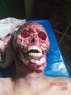 21-year-old-girl-found-face-skinned-5.jpg