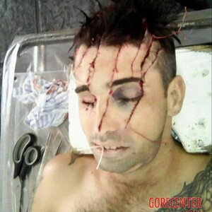 Dude-dies-with-his-head-destroyed-after-machete-attack-7.jpg