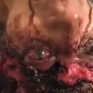 Maggots-eating-her-brain-while-shes-still-alive_thumb1-250x200.jpg