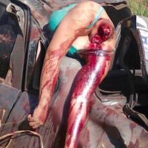 Decapitated-woman-in-car-crash-7-250x200.jpg