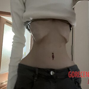 MIX-Extreme-cases-of-anorexia-21.jpg