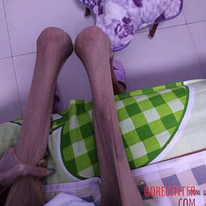 MIX-Extreme-cases-of-anorexia-22.jpg