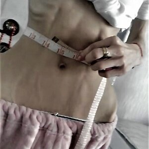 MIX-Extreme-cases-of-anorexia-27.jpg