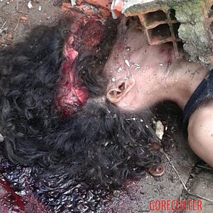 Young-girl-with-smashed-head-from-concrete-block-2.jpg