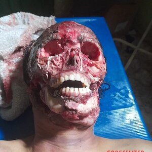 21-year-old-girl-found-face-skinned-5.jpg