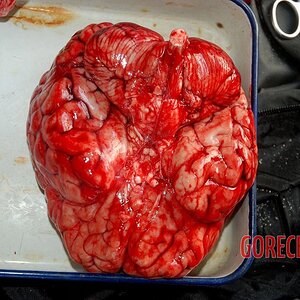 Autopsy-of-brain-after-stroke-1.jpg