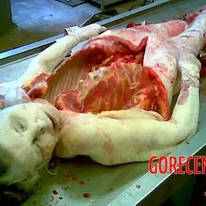 MIX-Autopsies-of-women-9.webp