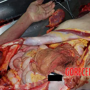 MIX-Autopsies-of-women-2 (1).webp