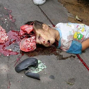 very-graphic-pictures-of-2-Year-old-toddler-01.jpg
