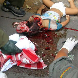 very-graphic-pictures-of-2-Year-old-toddler-02.jpg