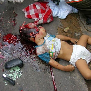 very-graphic-pictures-of-2-Year-old-toddler-03.jpg