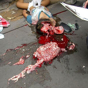 very-graphic-pictures-of-2-Year-old-toddler-04.jpg