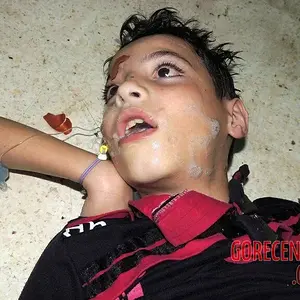 child-victims-of-chemical-attack-in-syria-2-447261454.webp