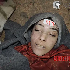 female-victims-of-chemical-attack-9-6837647734.webp