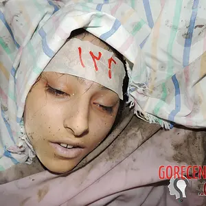 female-victims-of-chemical-attack-1-2386744013.webp