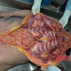 Autopsy-of-strangled-Chinese-woman-12.webp