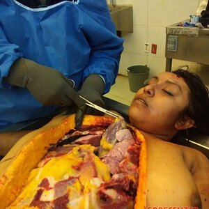 Autopsy-of-curvy-woman-2.jpg