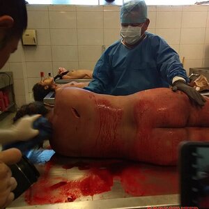 Autopsy-of-curvy-woman-4.jpg