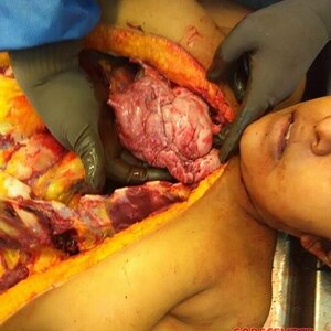 Autopsy-of-curvy-woman-7.jpg