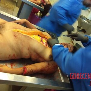 Autopsy-of-curvy-woman-8.jpg