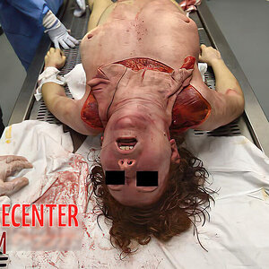 Skinned-woman-on-autopsy-table-1.jpg