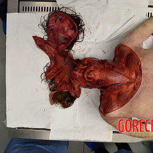 Skinned-woman-on-autopsy-table-5.jpg